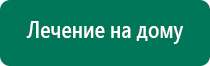 Аппараты стл производство